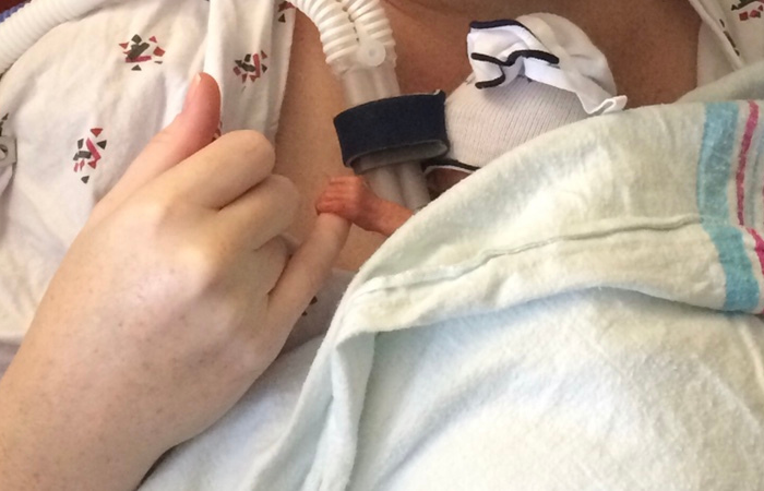  Trusting our Twin Daughters to UAB Was the Right Choice