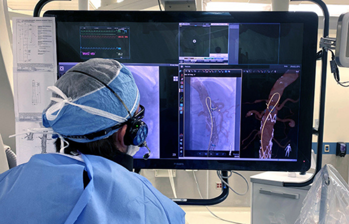  UAB First in Southeast to Use Light Visualization Technology for Vascular Procedures