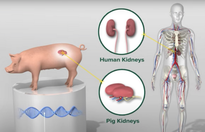 Digital diagram comparing pig kidneys and human kidneys