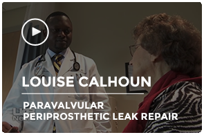 Louise Calhoun | Paravalvular Periprosthetic Leak Repair