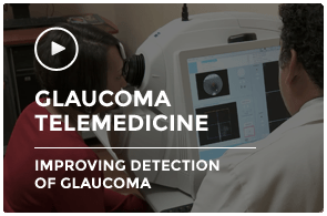 Glaucoma Telemedicine: Improving detection of glaucoma