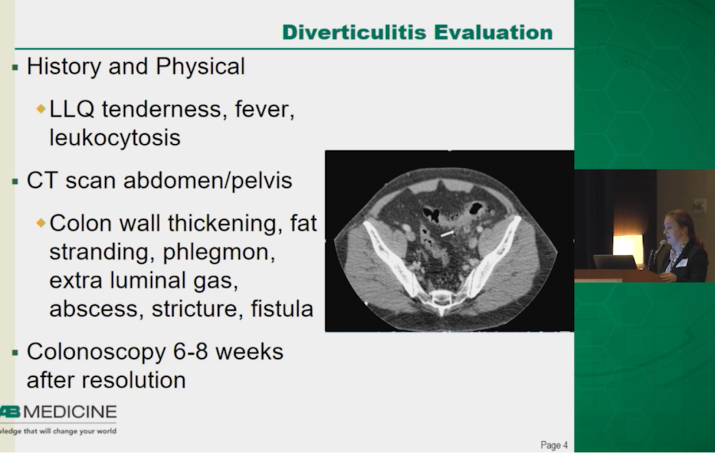 Diverticulitis: To Operate or Not? video
