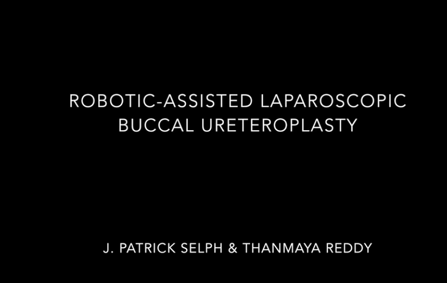 UAB Urology - Robotic Buccal Ureteroplasty