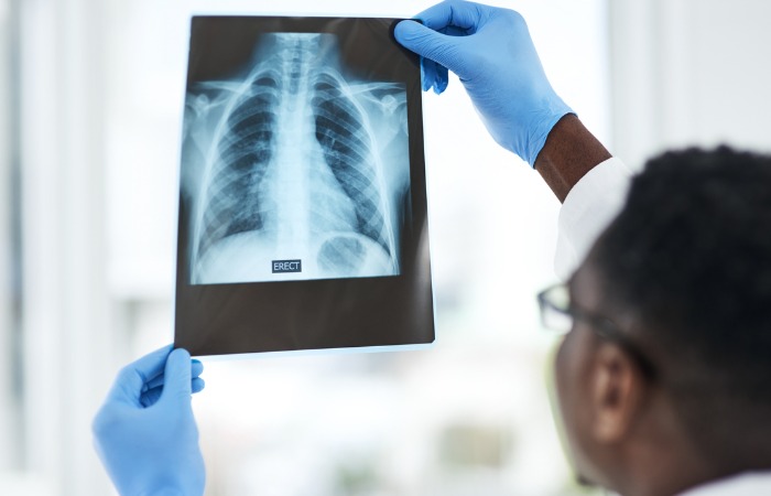  Donahue, Wei Expand General Thoracic Surgery Options in Alabama