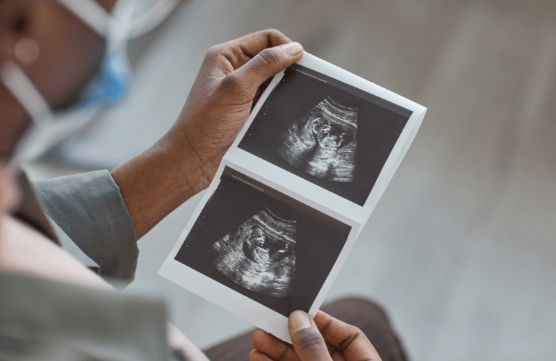 Ultrasound of potential birth defects