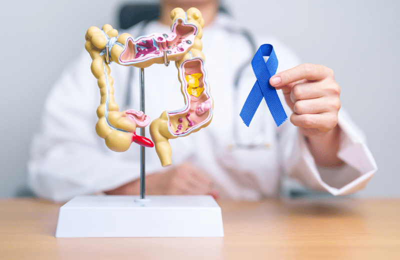  How UAB’s national accreditation for rectal cancer improves care