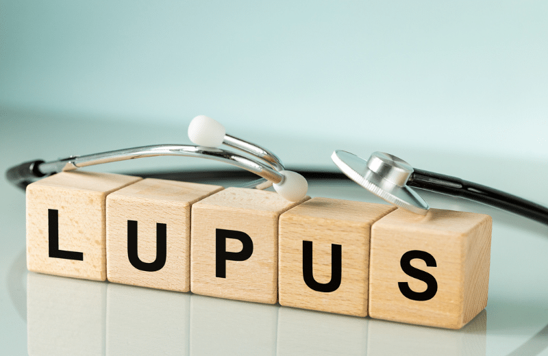 small wooden blocks that spell lupus
